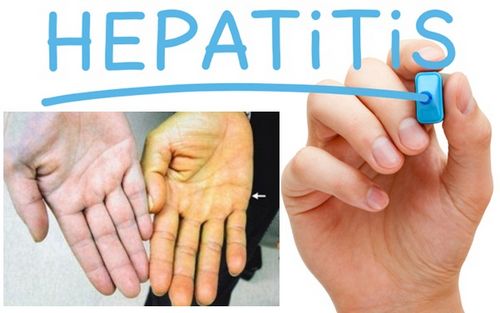 Hepatitis B - Gejala lebih tinggi mengalami komplikasi